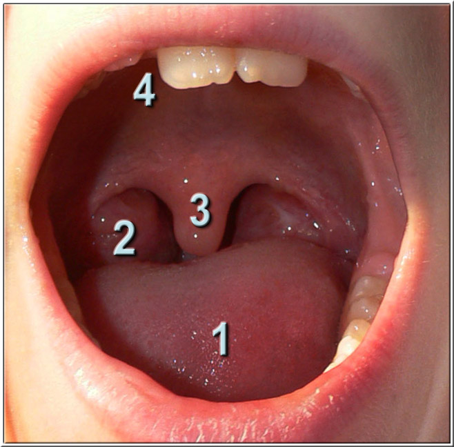 luette palatine uvula
